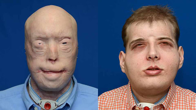 Operacion Rostro